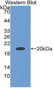 RBM20 Antibody