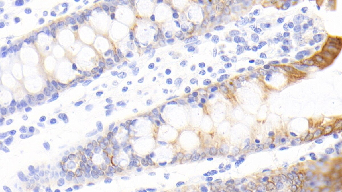 FAM5C Antibody