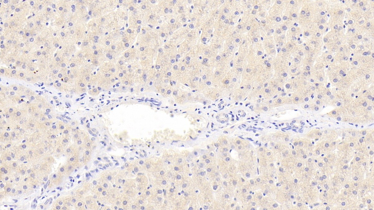 COQ10B Antibody
