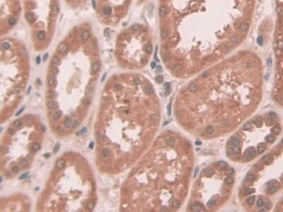 ABCC10 Antibody