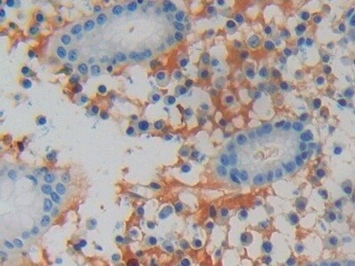 LCN15 Antibody