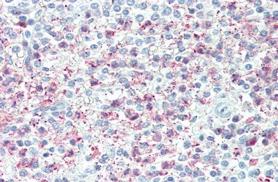 TSG-6 Antibody