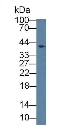 EPHX4 Antibody