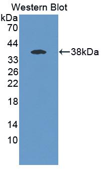 EPHX4 Antibody