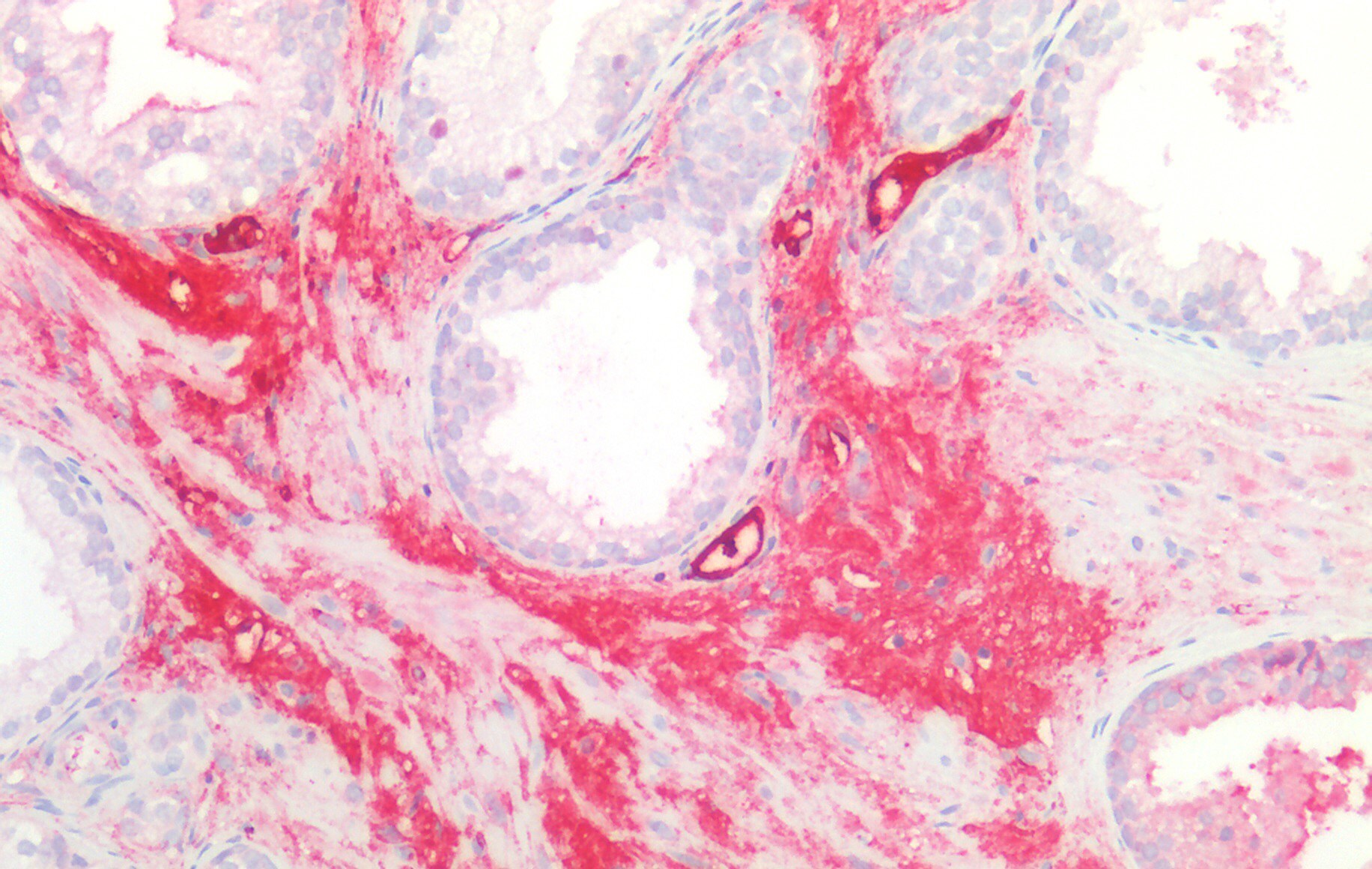 NCU-G1 Antibody