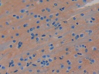 LRIG3 Antibody