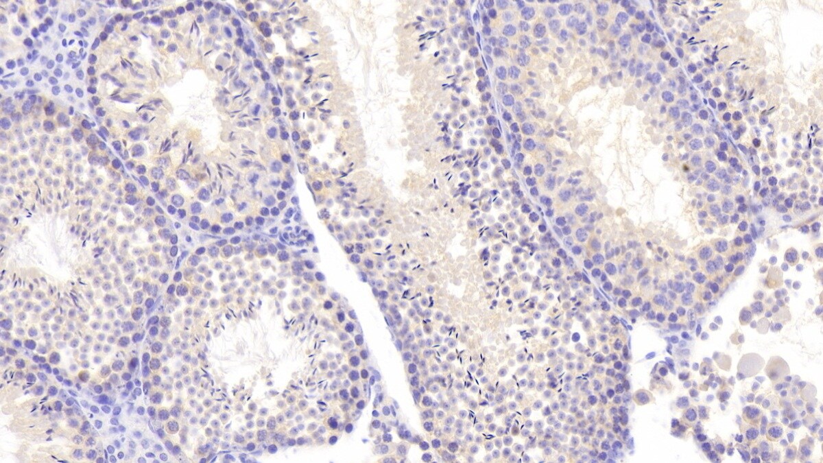 NEI3 Antibody