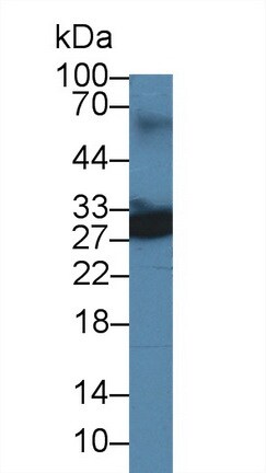 UCH-L4 Antibody