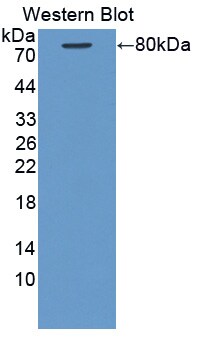 KRT28 Antibody
