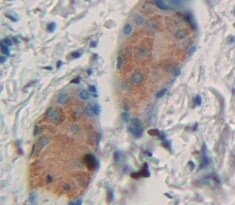 KRT28 Antibody