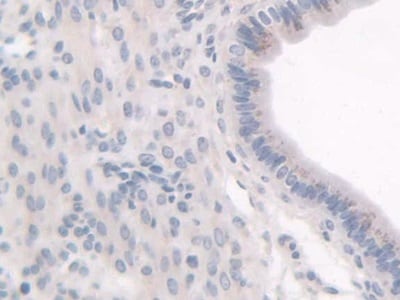 HPS1 Antibody