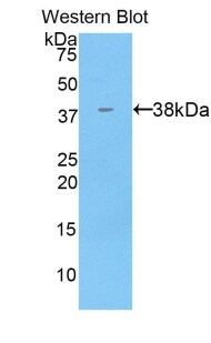 Cytokeratin 71 Antibody