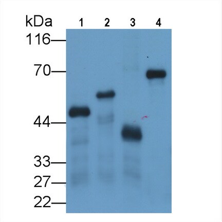 Glutathione S-Transferase/GST Antibody (C11)