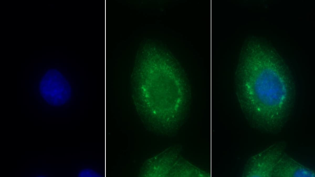 Endothelin-1 Antibody (5#)
