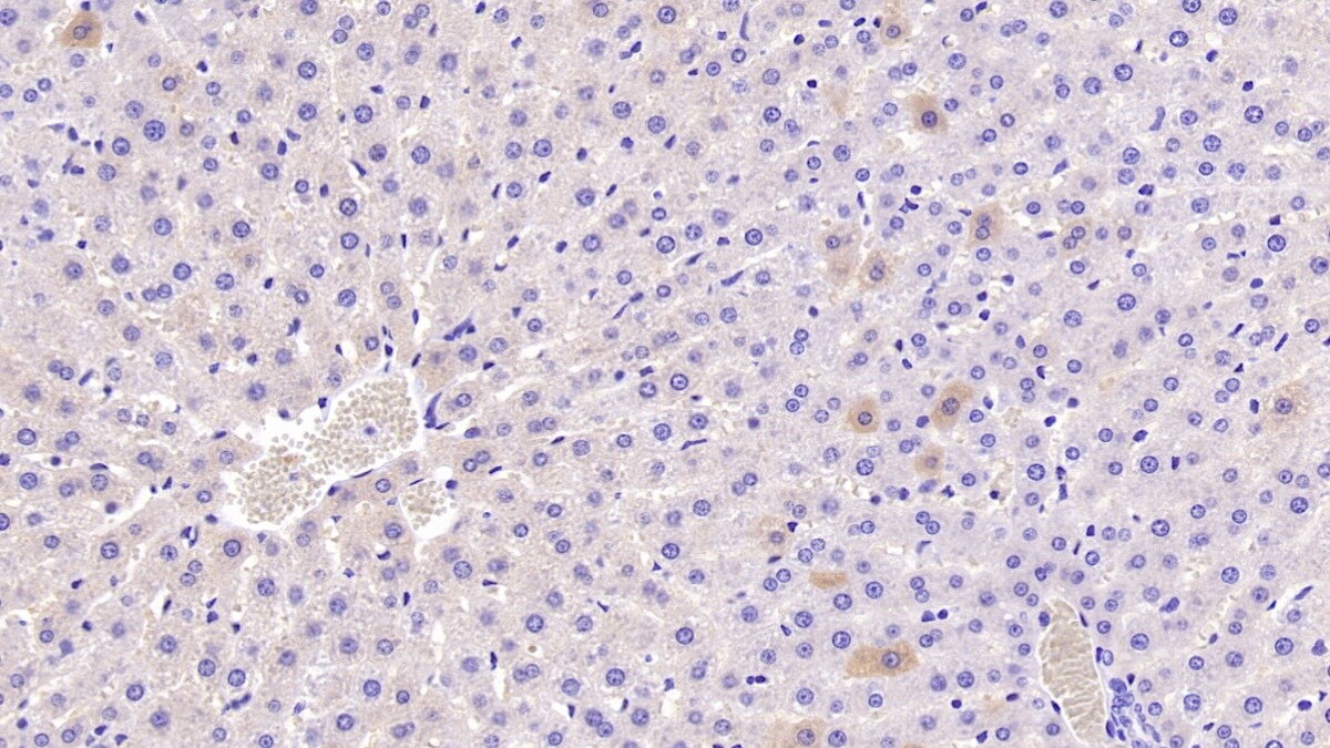 CRAT Antibody (C2)