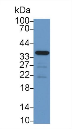 CRHBP Antibody (C11)