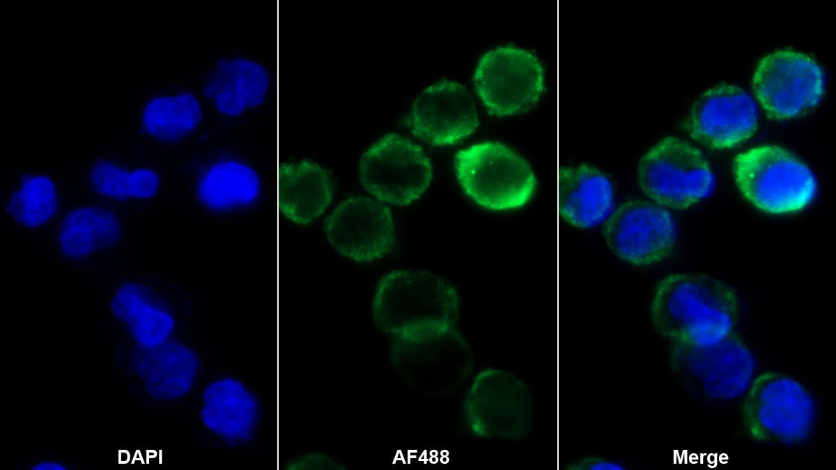 Hemoglobin epsilon Antibody (D4)