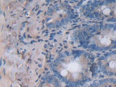IL-24 Antibody (C1)