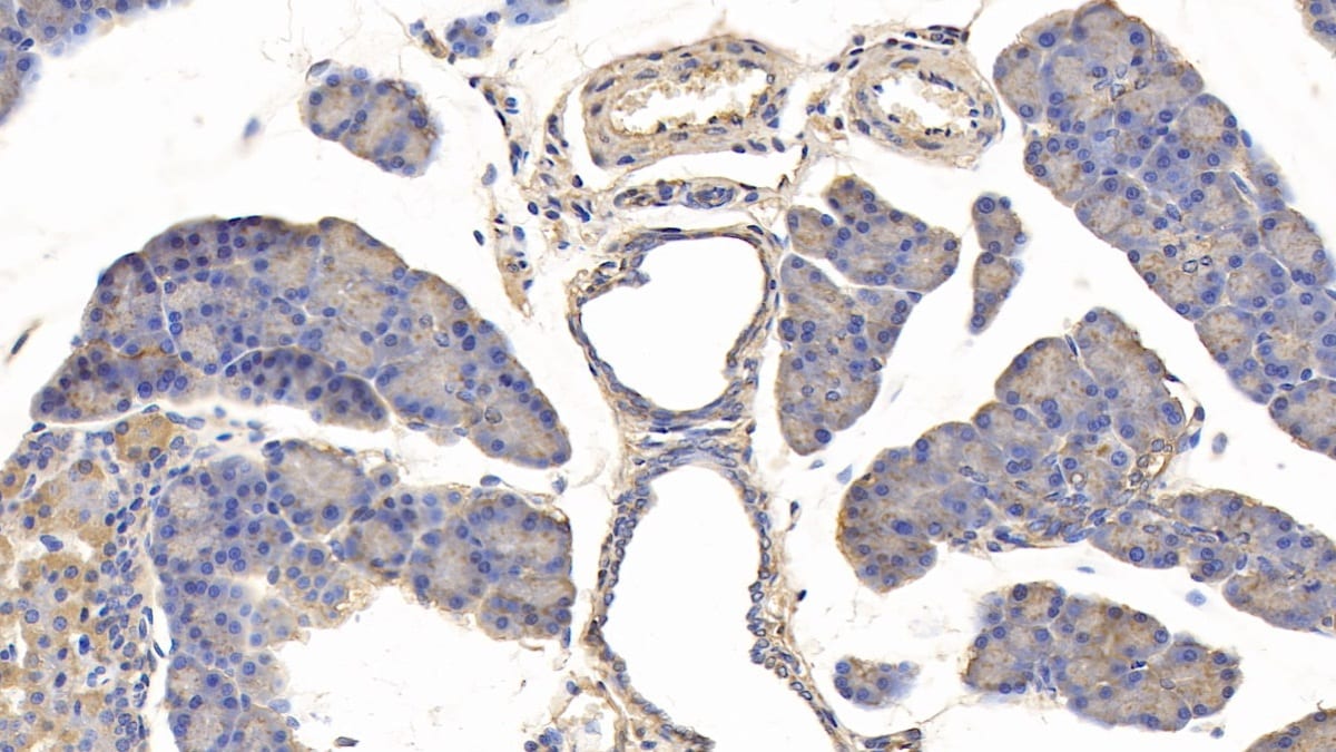 IGFBP-5 Antibody (C1)