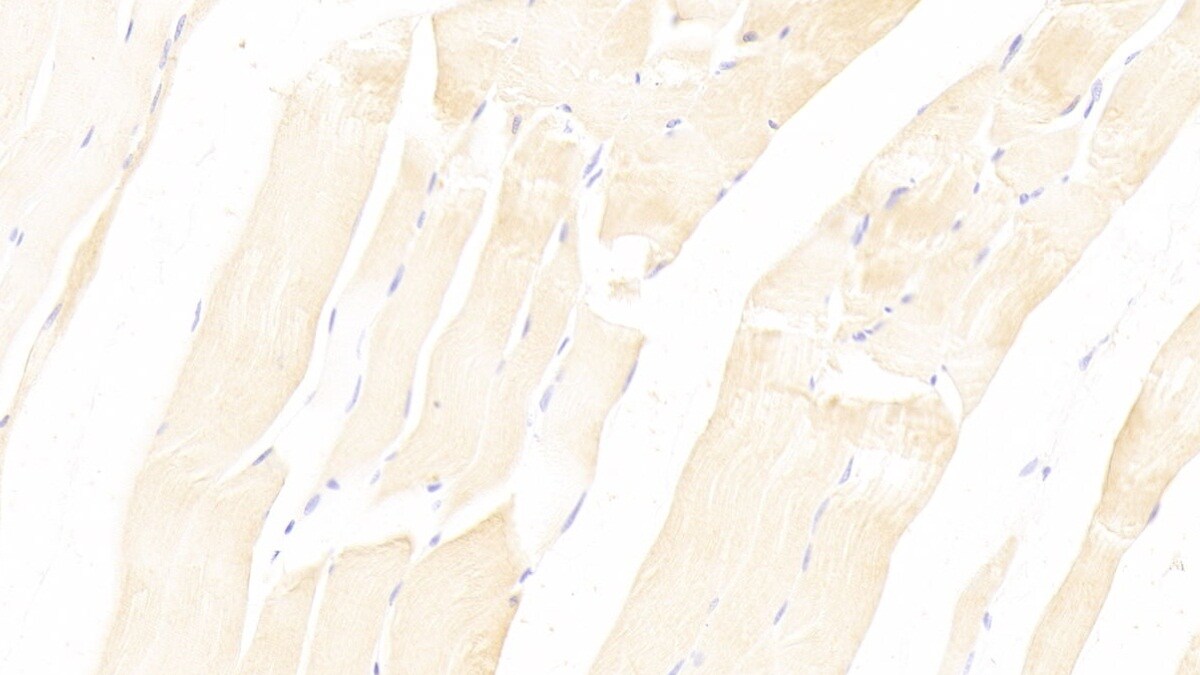 Neuropilin-2 Antibody (D15)