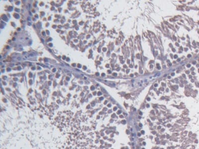 Fibulin 1 Antibody (C2)