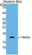 RAIDD/CRADD Antibody (23#)