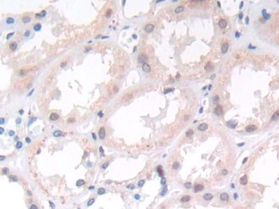 Matriptase/ST14 Antibody (C4)