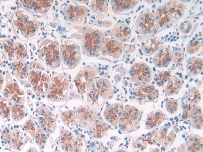 Matriptase/ST14 Antibody (C4)