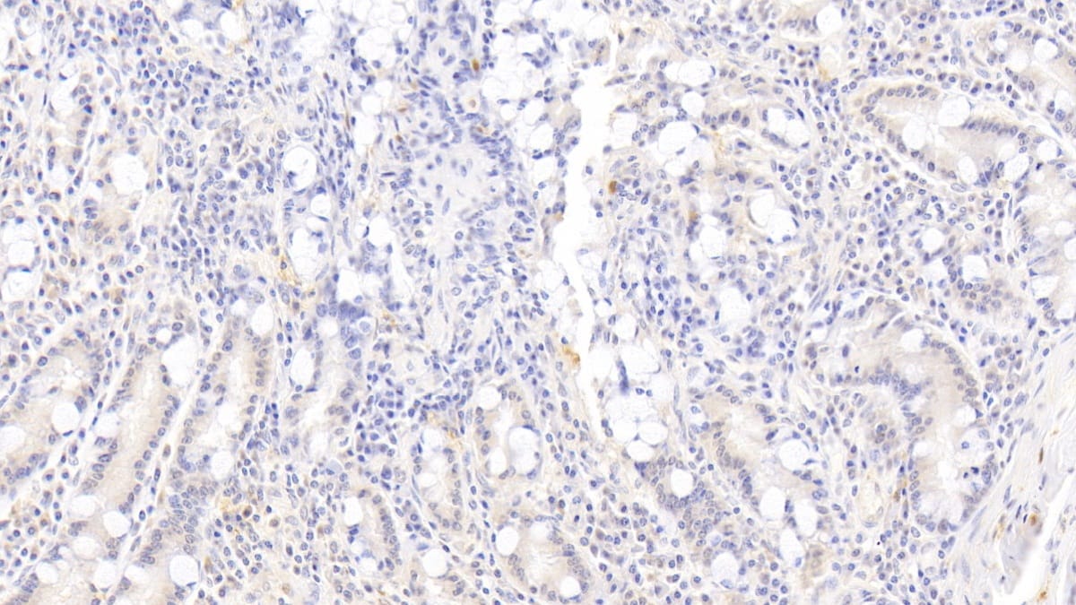 Rac1 Antibody (C1)