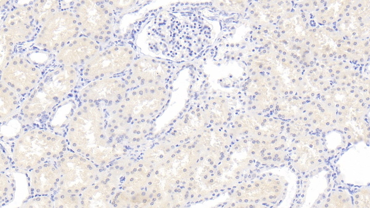 RHD Antibody (C2)