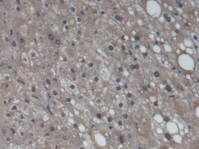 Cytochrome P450 3A7 Antibody (C2)