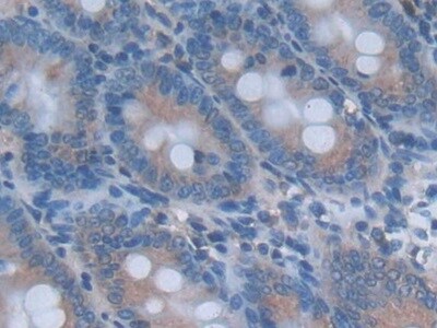 IL-24 Antibody (C6)