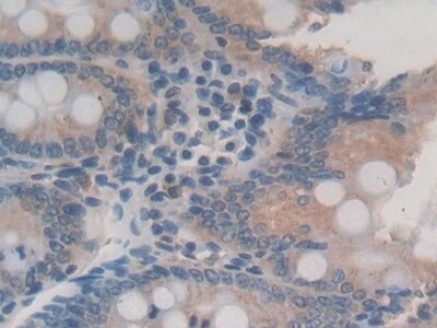 IL-24 Antibody (C7)