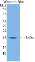 IL-36 gamma/IL-1F9 Antibody (D2)