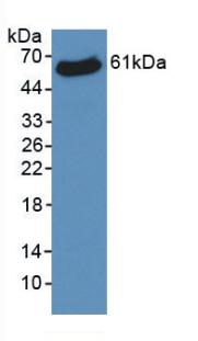 VDAC1 Antibody (C1)