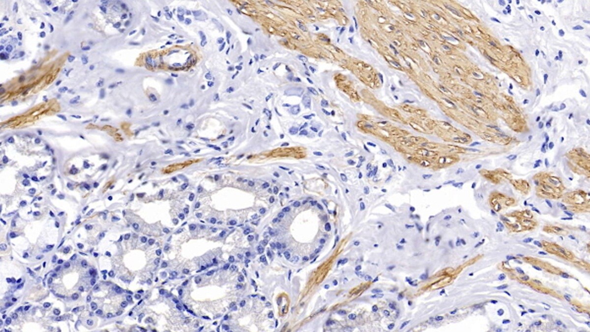 Actin Alpha 1 Cardiac Muscle Antibody (C3)