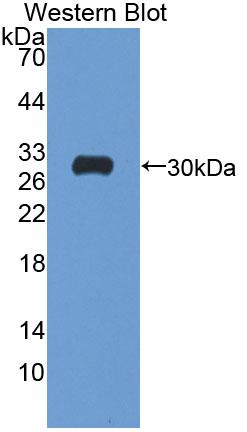 ATP1B4 Antibody
