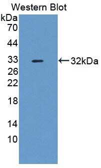 METTL21C Antibody