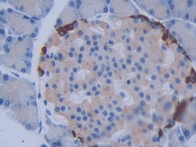 METTL21C Antibody