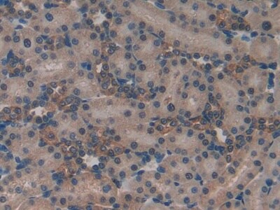 MT-ND5 Antibody
