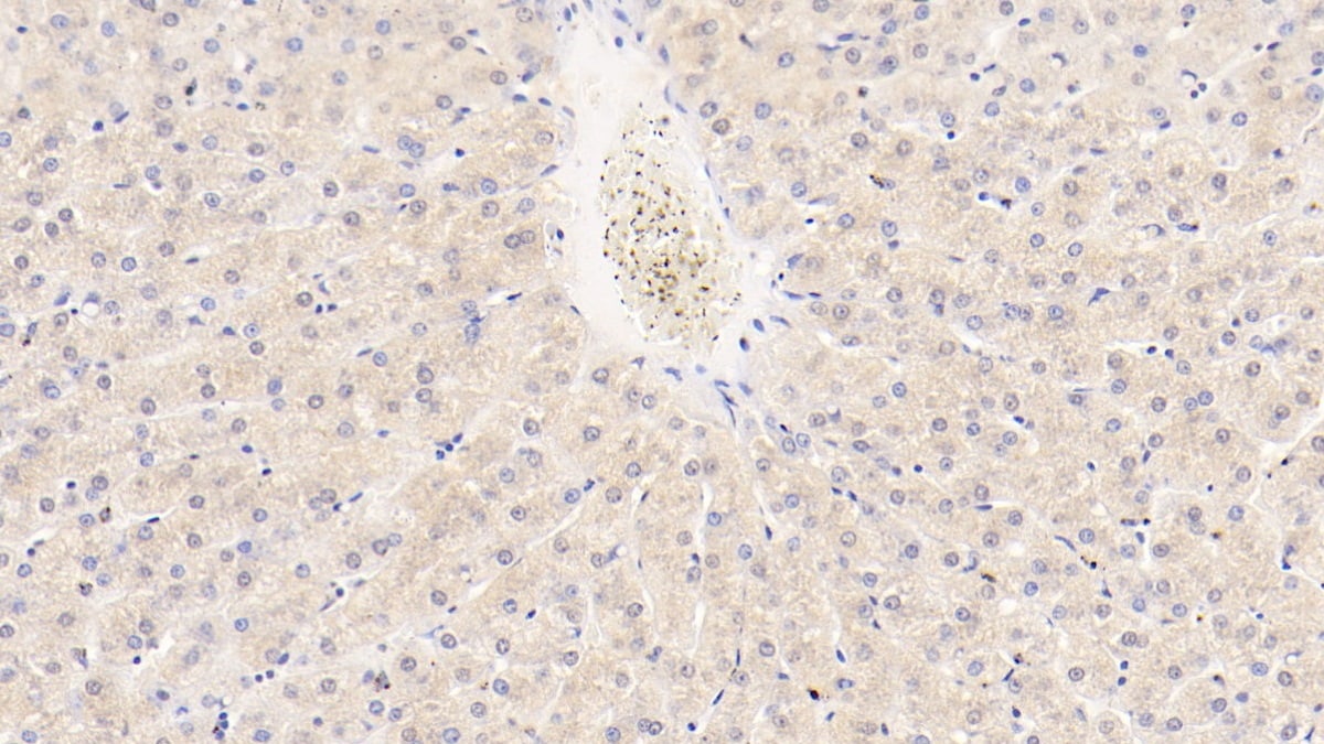 Angiopoietin-like protein 8/Betatrophin Antibody (C5)