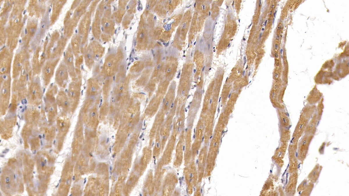Semaphorin 5B Antibody (C15)