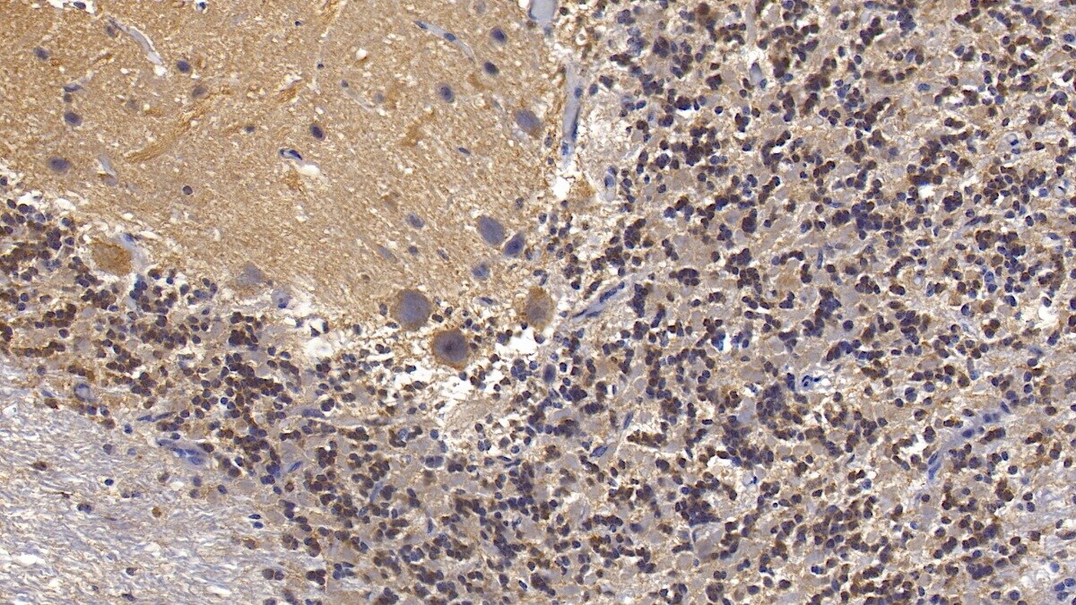 Semaphorin 5B Antibody (C15)