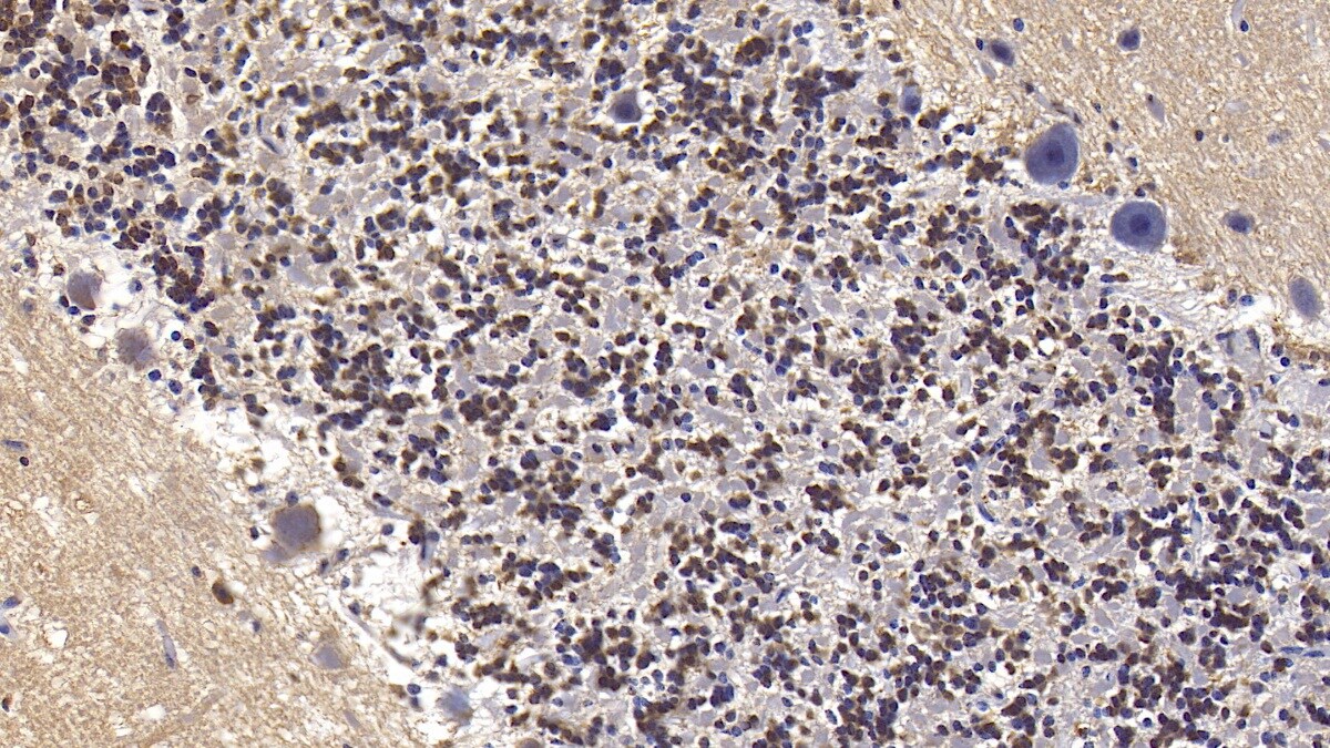 Semaphorin 5B Antibody (C17)