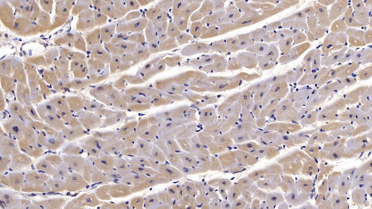 Semaphorin 5B Antibody (C4)