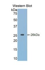 Cathepsin K Antibody (1#)