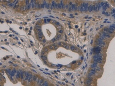Fibulin 1 Antibody (C12)