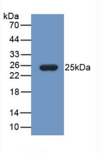 Fibulin 1 Antibody (C12)
