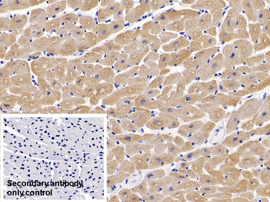 Actin Alpha 1 Cardiac Muscle Antibody (C4)