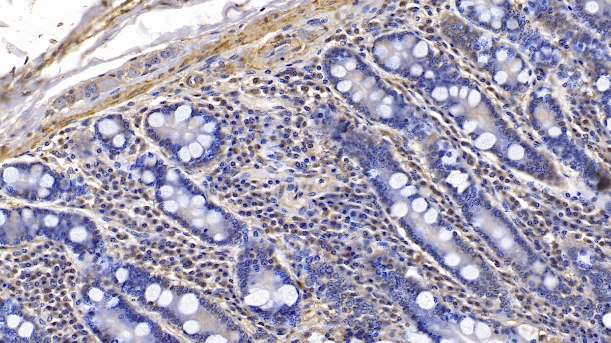 Actin Alpha 1 Cardiac Muscle Antibody (C4)